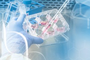 Pipette und Laborschalen in einem Biotech-Labor (Symbolbild, Foto: freepik, rawpixel.com) - Biontech Krebsmittel: Antikörper gegen Tumor – Millionendeal mit US-Firma